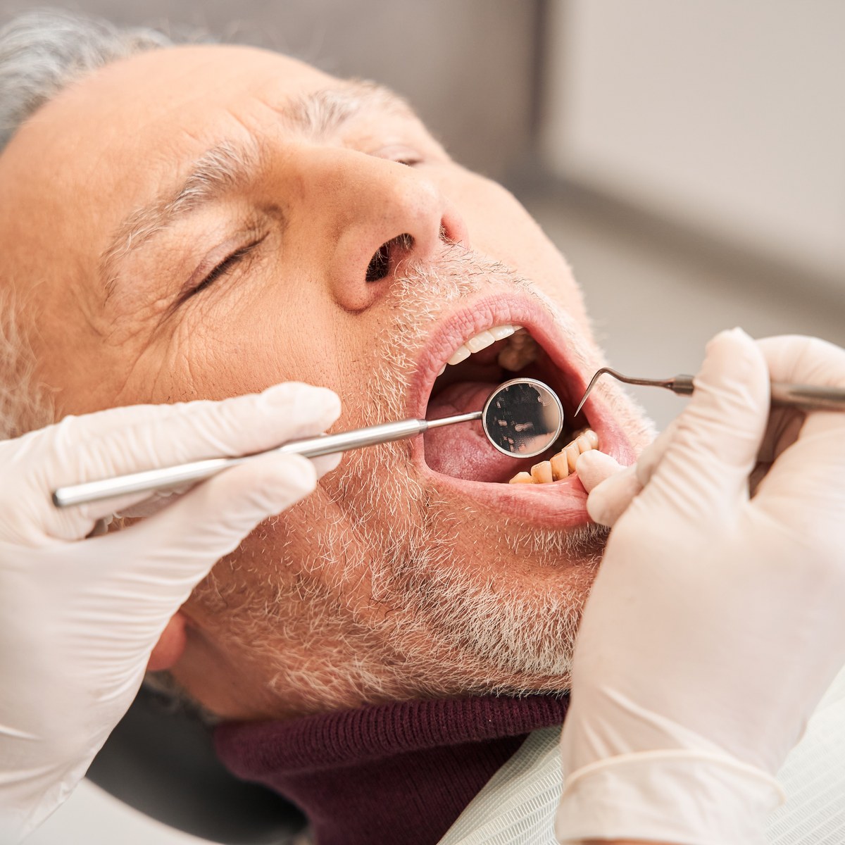 Guantes de látex desechables en una clínica dental